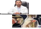 عمل تعویض مفصل شانه در بیمارستان امام‌خمینی (ره) صومعه‌سرا