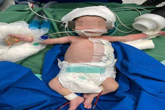 انجام موفقیتآمیز عمل جراحی کیست مادرزادی جدار شکم بر روی نوزاد ۱۱ روزه در مرکز آموزشی و درمانی ۱۷ شهریور انجام موفقیتآمیز عمل جراحی کیست مادرزادی جدار شکم بر روی نوزاد ۱۱ روزه در مرکز آموزشی و درمانی ۱۷ شهریور